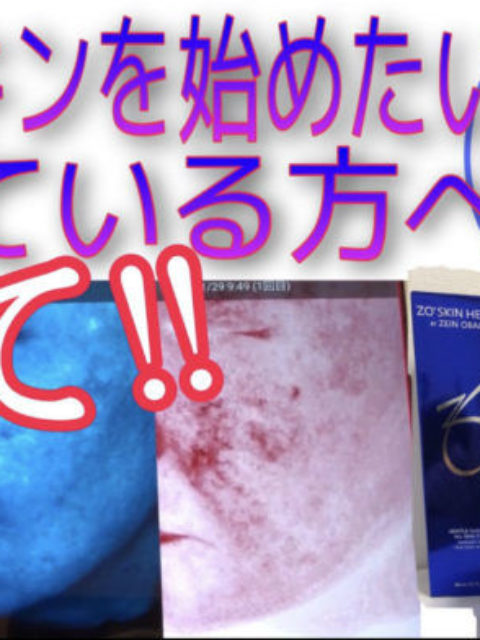 YouTube更新：ゼオスキン はどこで始めても同じ？当院のこだわり解説