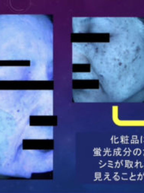 肌画像解析機の診断について注意喚起