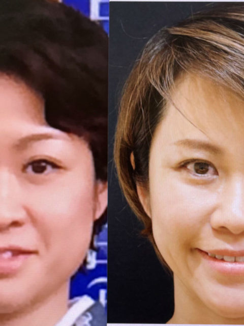 西田美穂の「顔の歴史」と「美容医療の履歴」