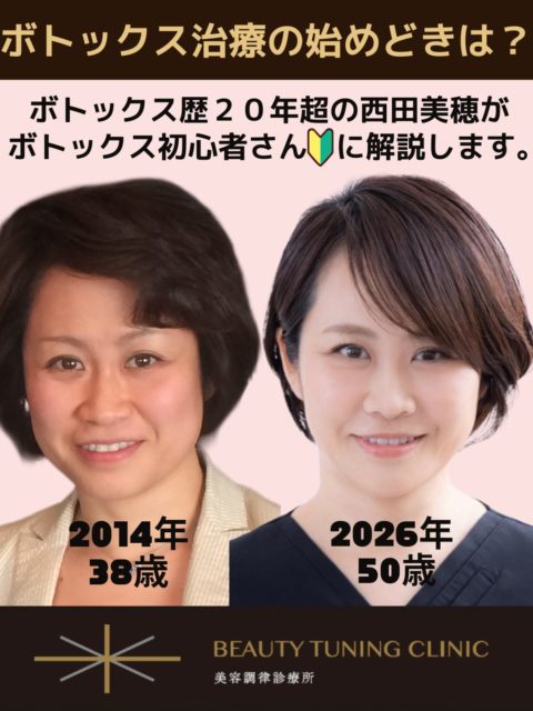 ボトックス歴20年超の私が伝えたい　ボトックスの始めどきとは？