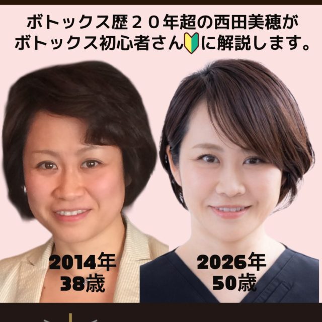 ボトックス歴20年超の私が伝えたい　ボトックスの始めどきとは？