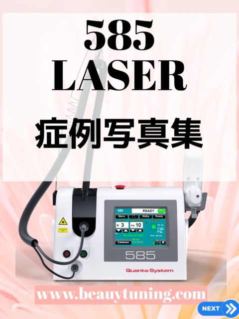 585レーザー　症例写真集