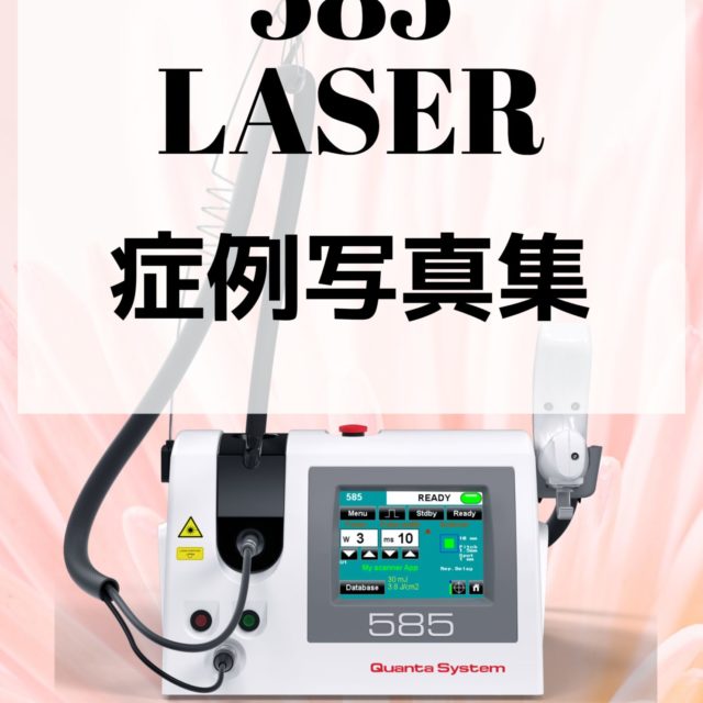 585レーザー　症例写真集